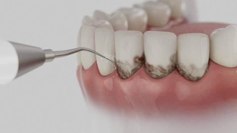 Reliable Dental Implants contractor in Tempe, AZ by Smile Center Dentistry
